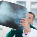 What Are My First Actions After a Spinal Cord Injury?